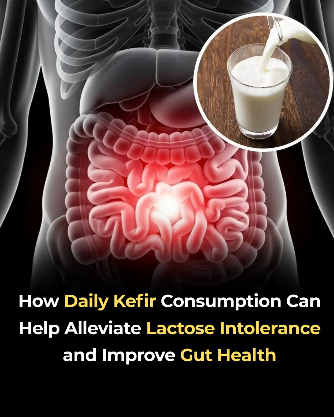 How Daily Kefir Consumption Can Help Alleviate Lactose Intolerance and Improve Gut Health