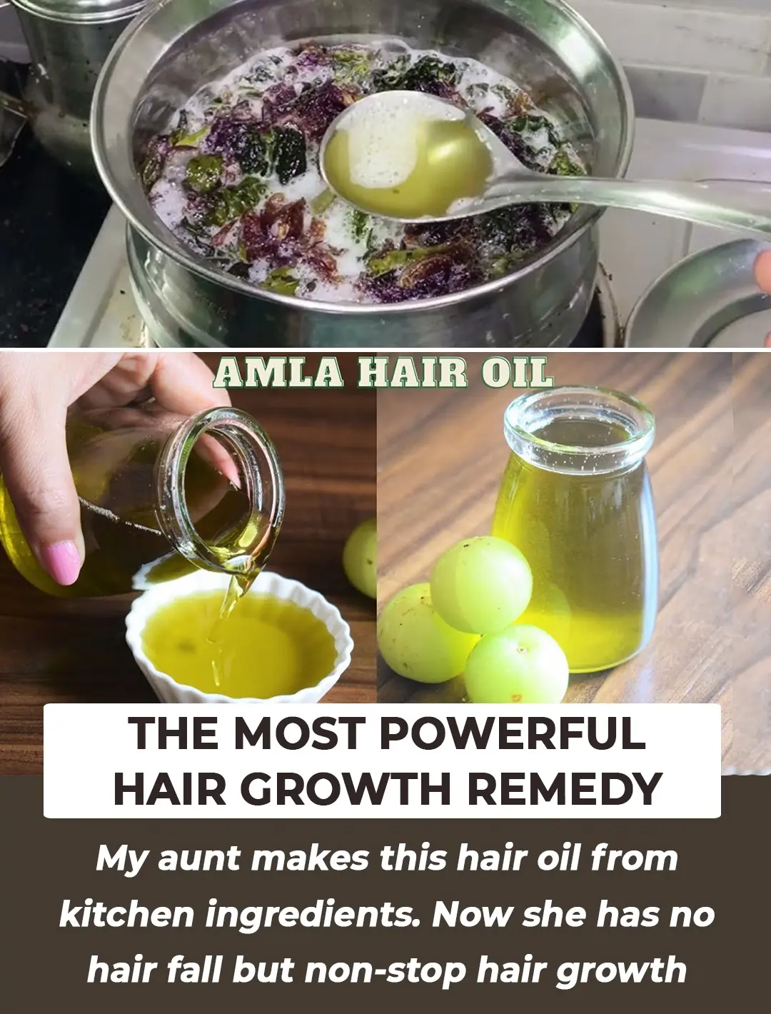 DIY Amla Hair Oil: No Hair Fall & Crazy Hair Growth