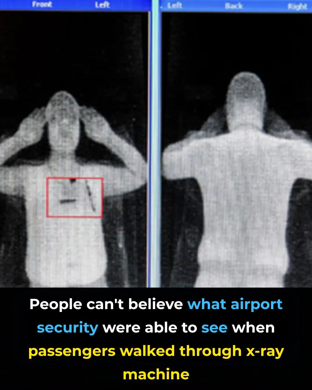 Airport X-Ray Scanners Upgrade: Shocking Level of Details