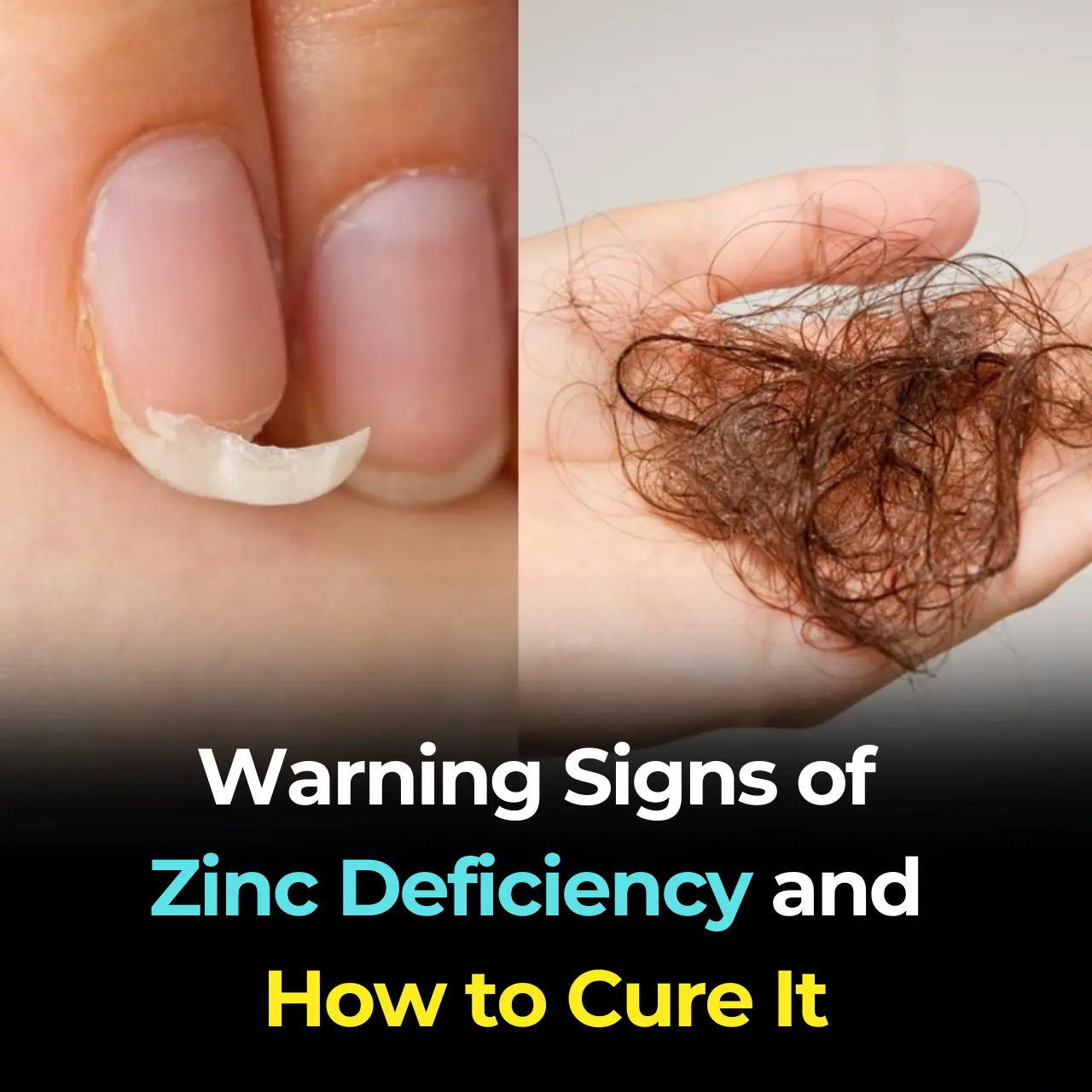 Warning Signs of Zinc Deficiency and How to Cure It