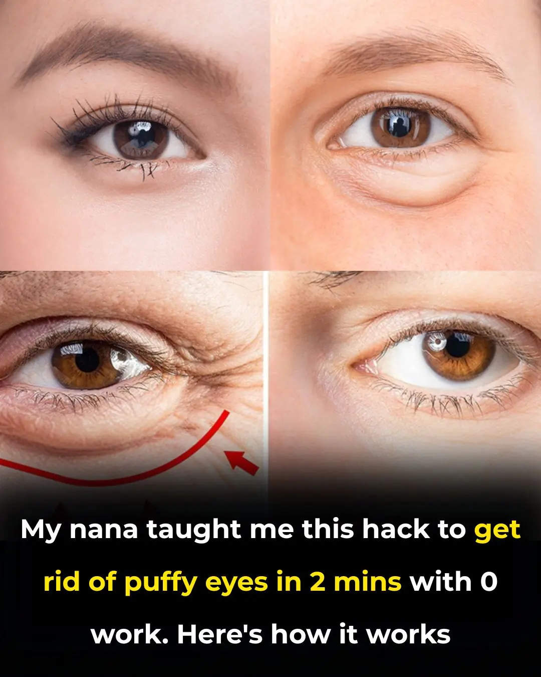 My Nana Taught Me This Hack to Get Rid of Puffy Eyes in 2 Minutes With Zero Work — Here’s How It Works