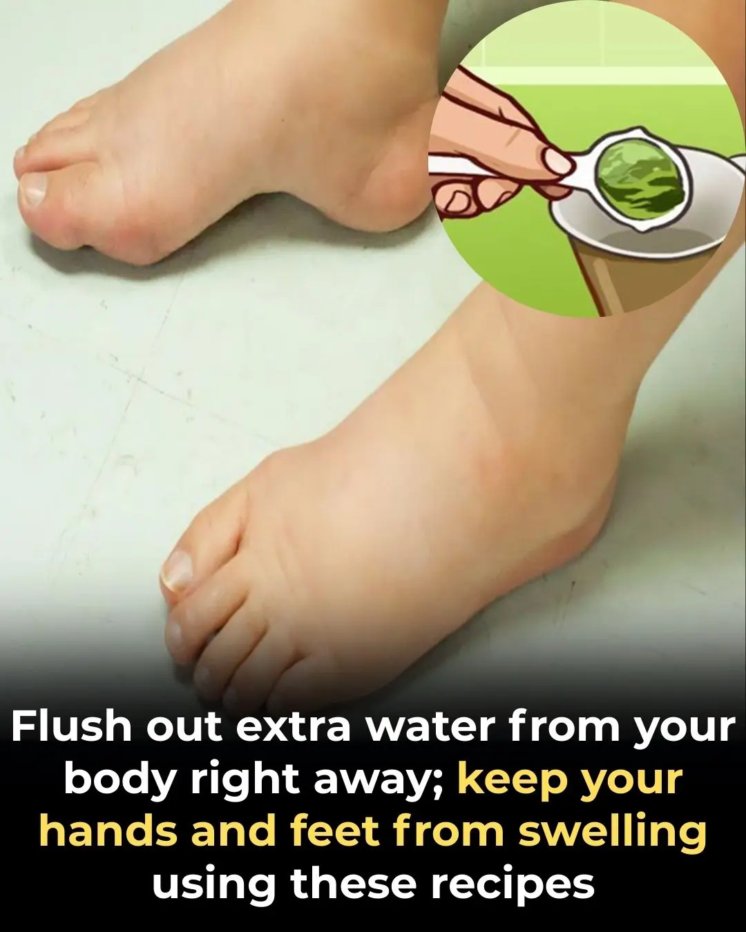 Say Goodbye to Swelling