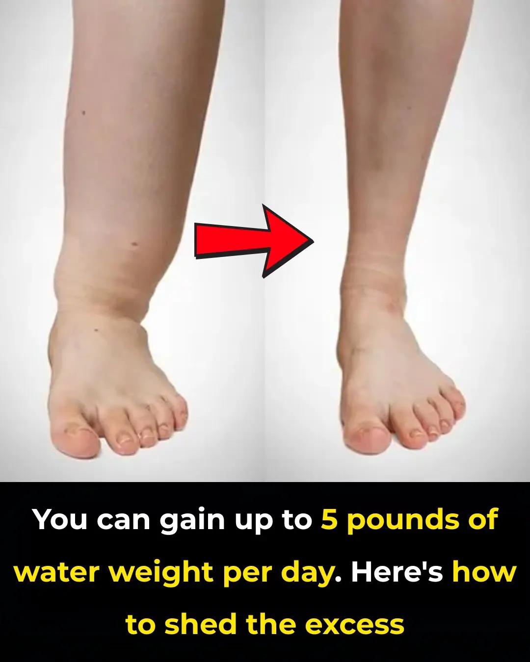 You can gain up to 5 pounds of water weight per day. Here's how to shed the excess
