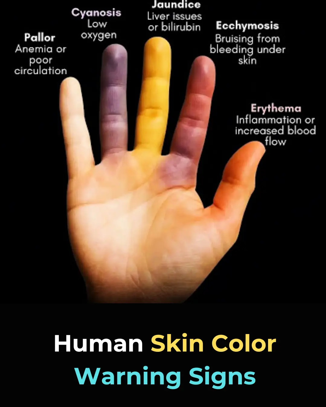 Understanding Skin Color Changes as Early Warning Signs of Health Issues