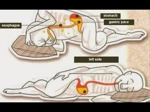 Why Sleeping on Your Left Side Is the Best Thing You’re Not Doing