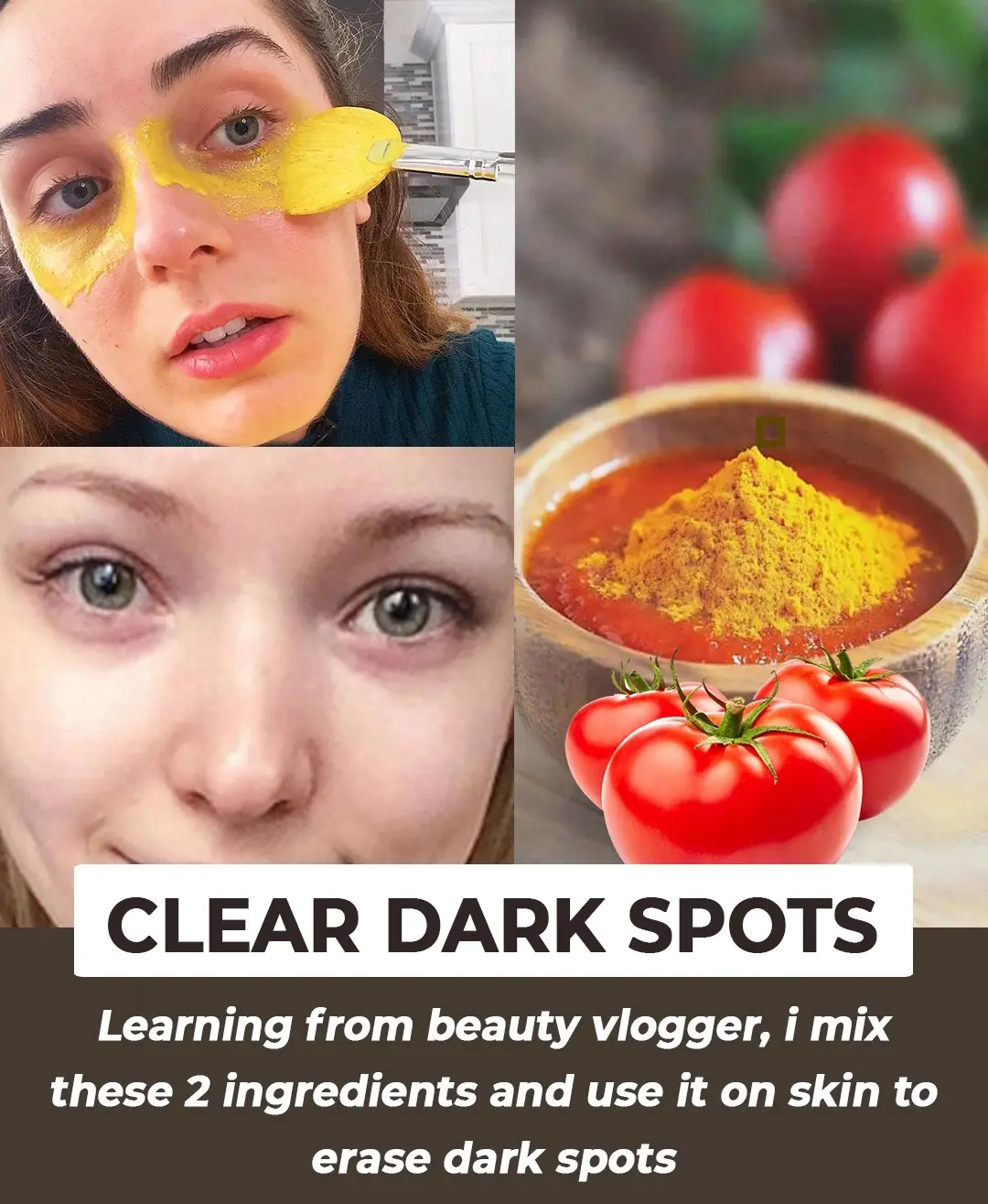 Tomato To Treat Hyperpigmentation, Dark Spots On Your Face