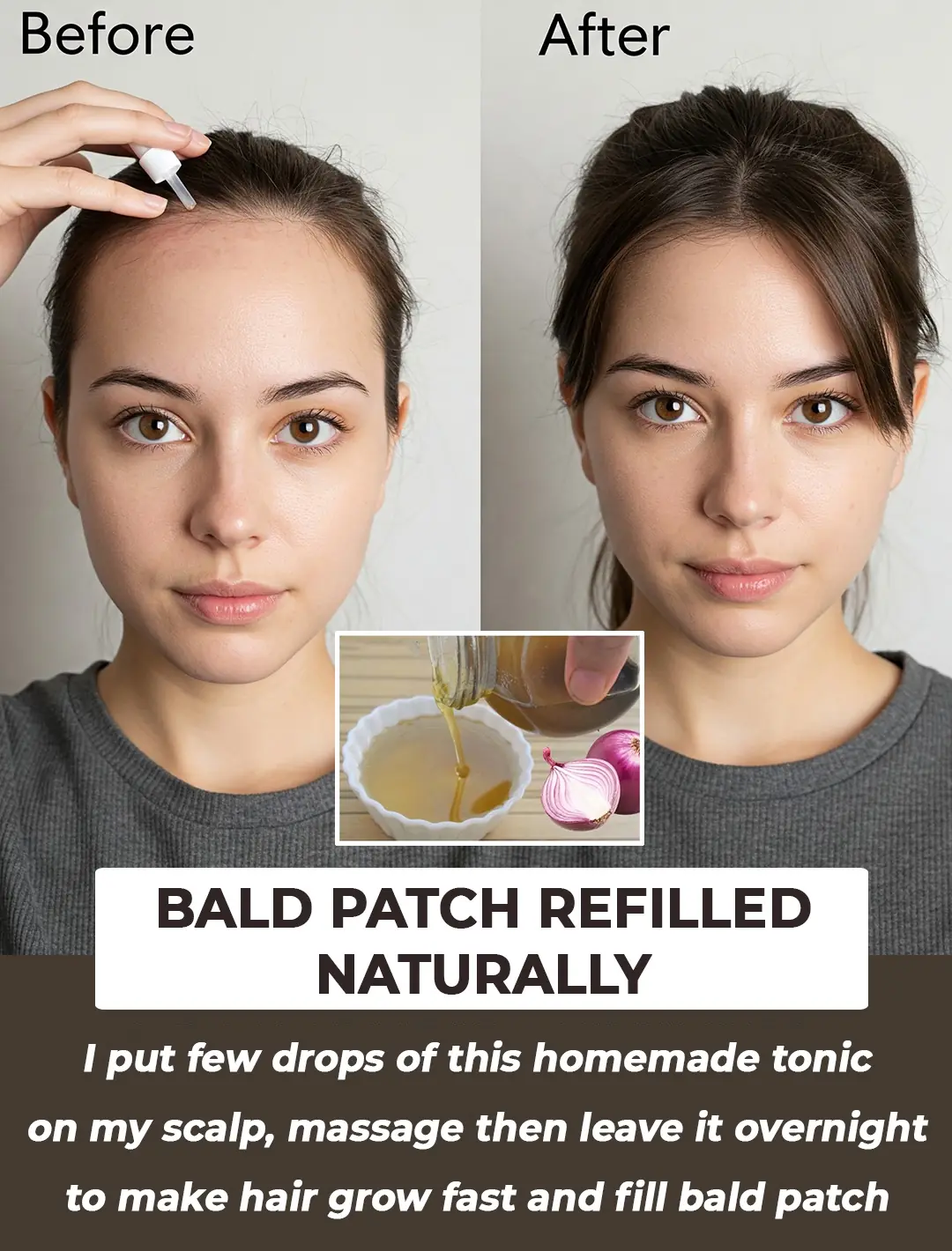 Double your hair growth with this “ONION JUICE” DIY