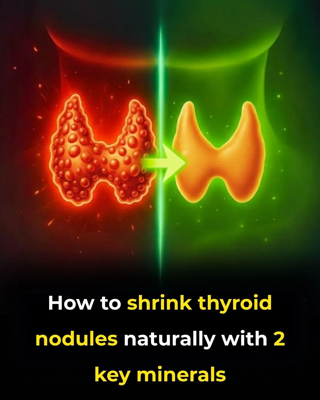 How to shrink thyroid nodules naturally with 2 key minerals