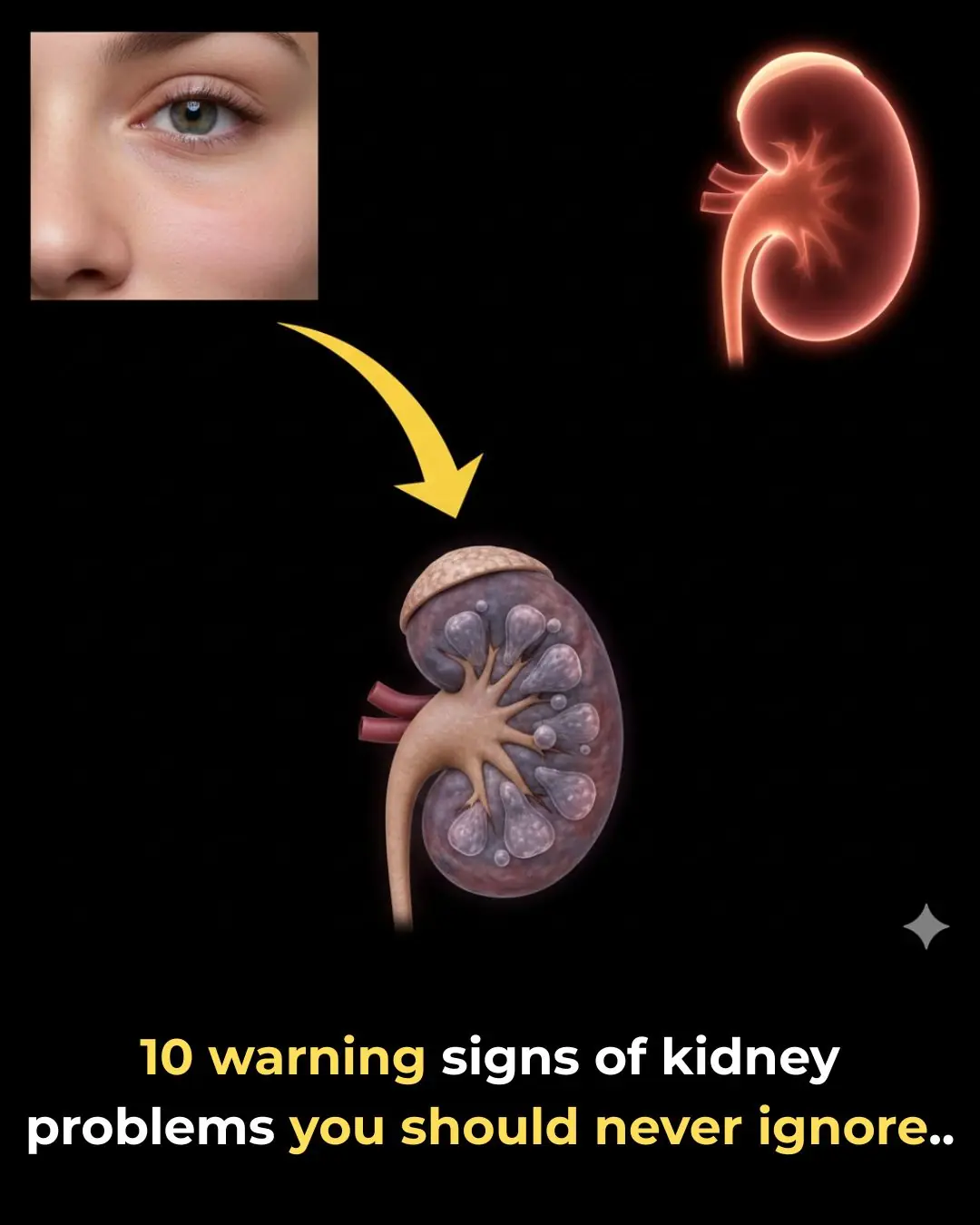 Top 10 Signs of Kidney Problems You ABSOLUTELY Must Be Aware Of…