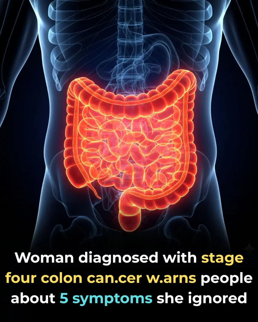 Woman reveals 5 colon cancer symptoms that shouldn’t be ignored