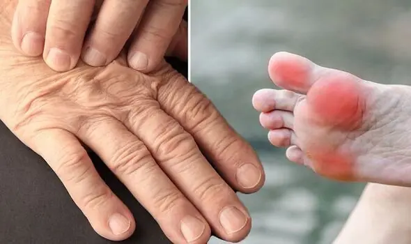 The FIRST Sign of VITAMIN B12 DEFICIENCY Is…