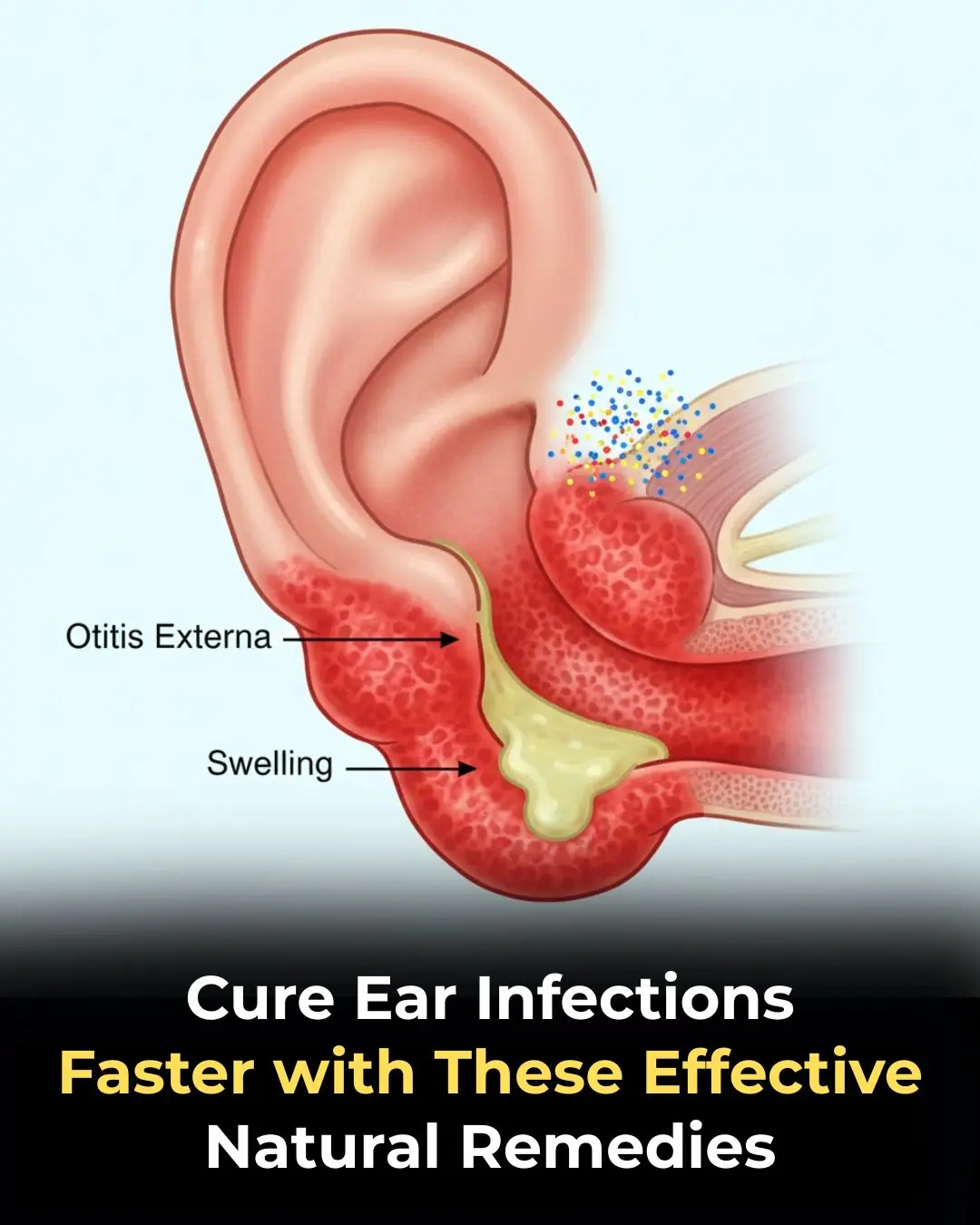 Managing Acute Otitis Media: Symptoms, Diagnosis, and Trusted Home Remedies