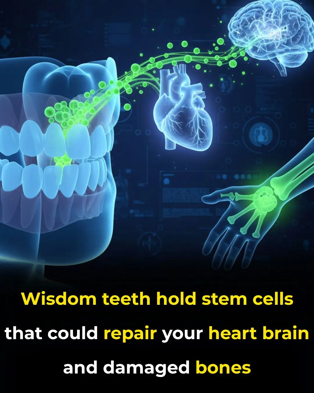 Scientists Unlock Healing Potential of Wisdom Teeth: Stem Cells for Regenerative Medicine