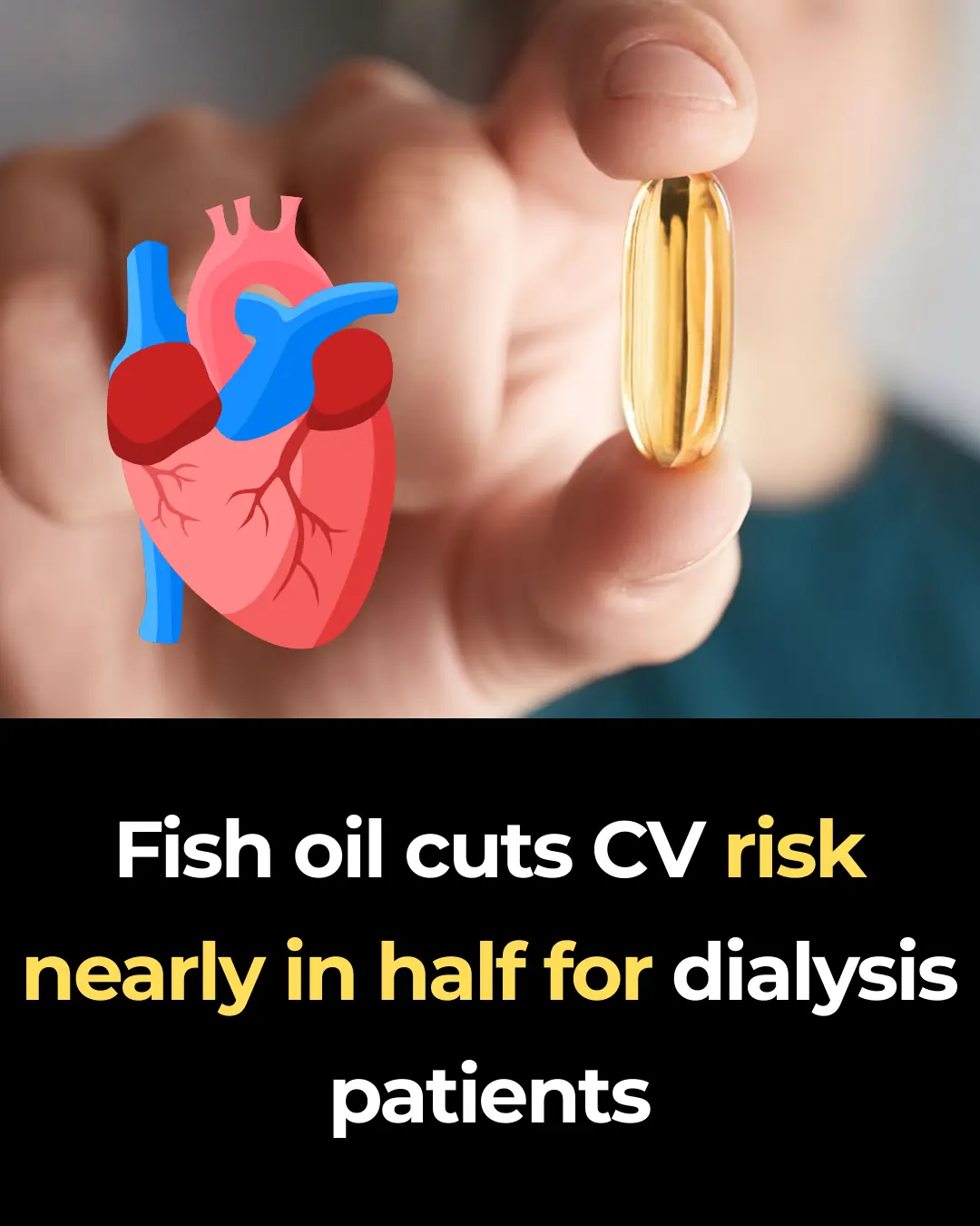 Fish oil cuts CV risk nearly in half for dialysis patients