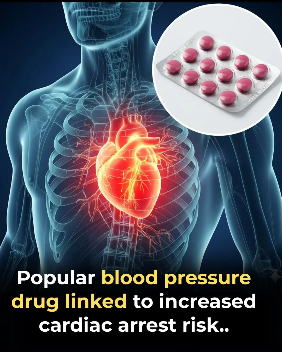 High-Dose Nifedipine Linked to Increased Risk of Sudden Cardiac Arrest, New Study Suggests