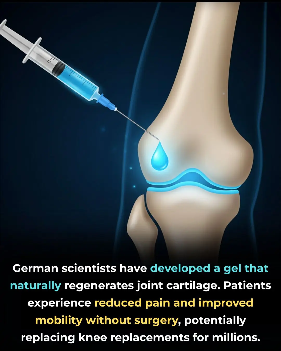 A Revolutionary German Gel May Repair Joints Naturally—Potentially Eliminating the Need for Surgery