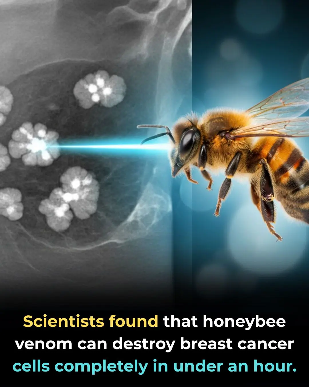 Honeybee Venom Can Destroy Breast Cancer Cells in Under an Hour — A Breakthrough That Could Transform Modern Medicine