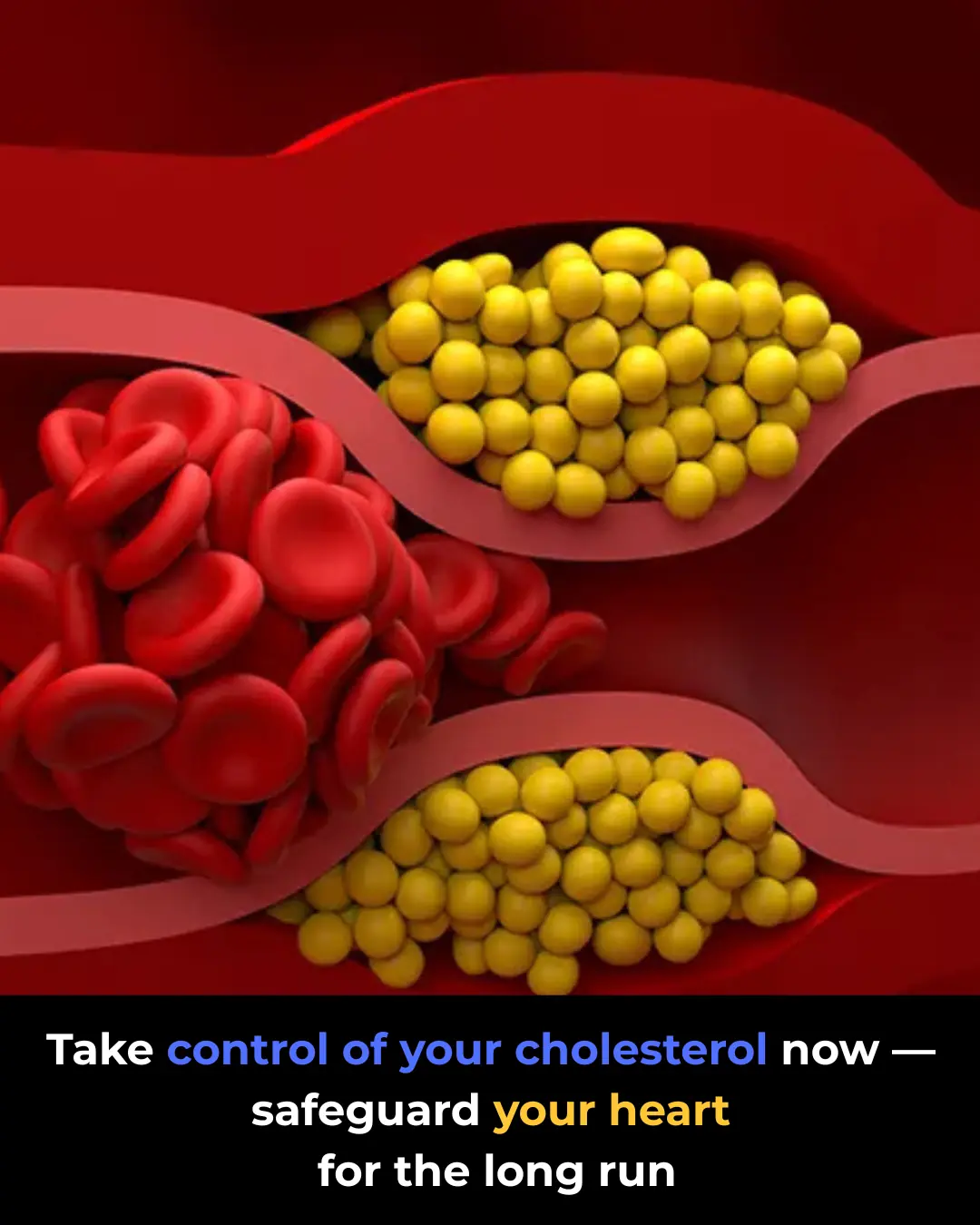 High Cholesterol: Causes, Risks, and Natural Ways to Lower It