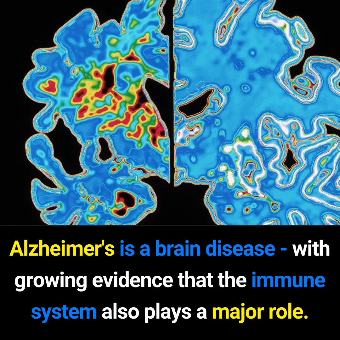 Understanding the Human Nervous System: How Brain Health, Immunity, and Vascular Function Work Together