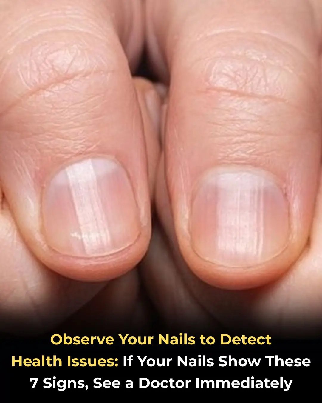 Nails: What Do They Reveal About Your Health