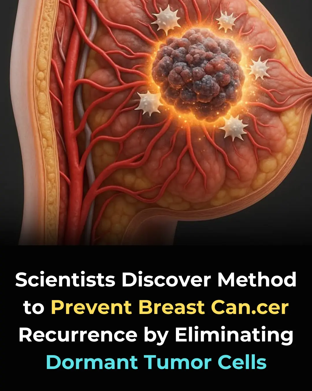 Eliminating Quiescent Tumor Cells: A New Frontier in Breast Cancer Survivorship Care