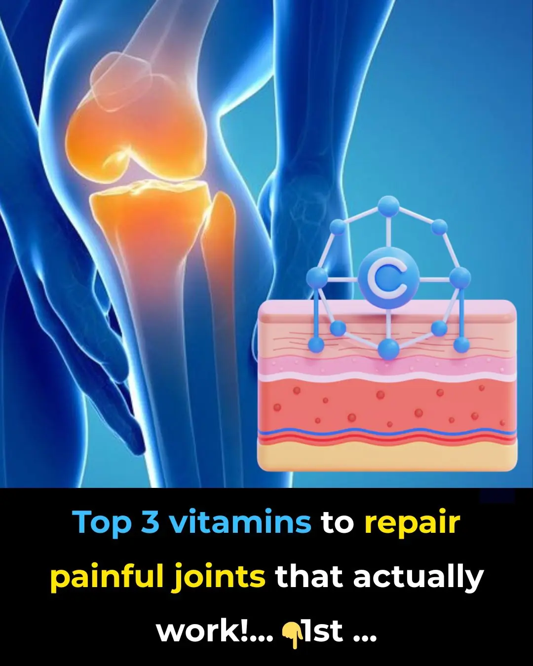 Top 3 vitamins to repair painful joints that actually work!