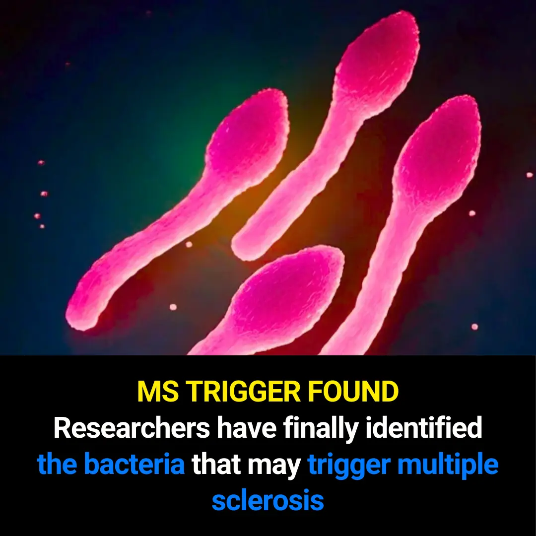 Scientists Identify Bacteria That May Trigger Multiple Sclerosis (MS): A Breakthrough in Neurological Research