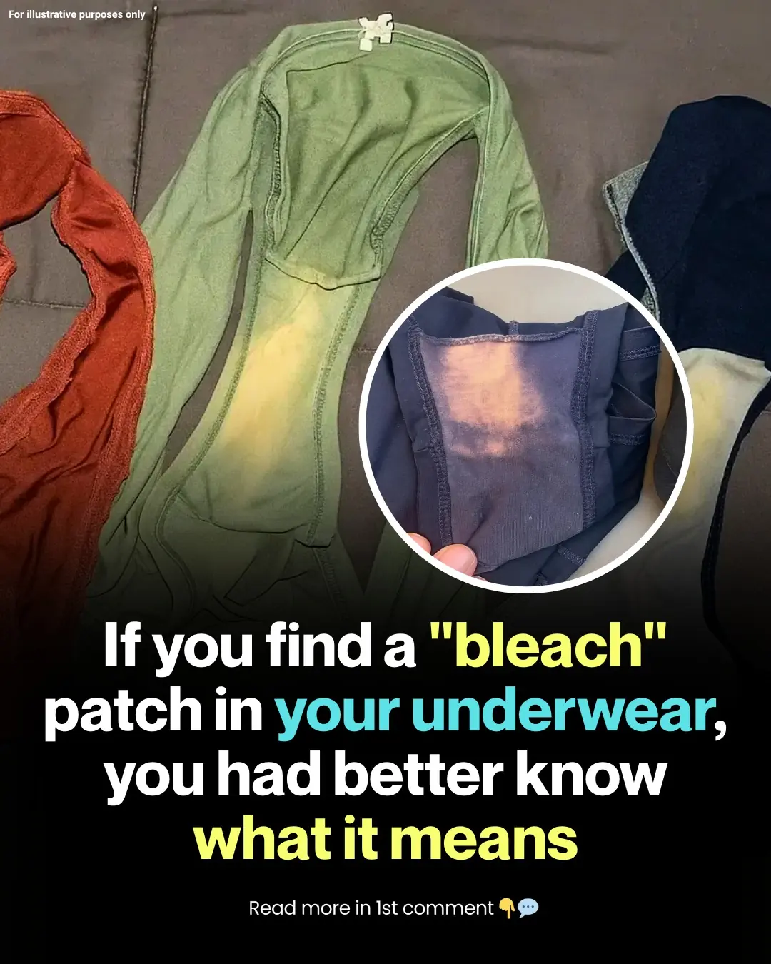 The Truth Behind Those Pale Patches on Underwear