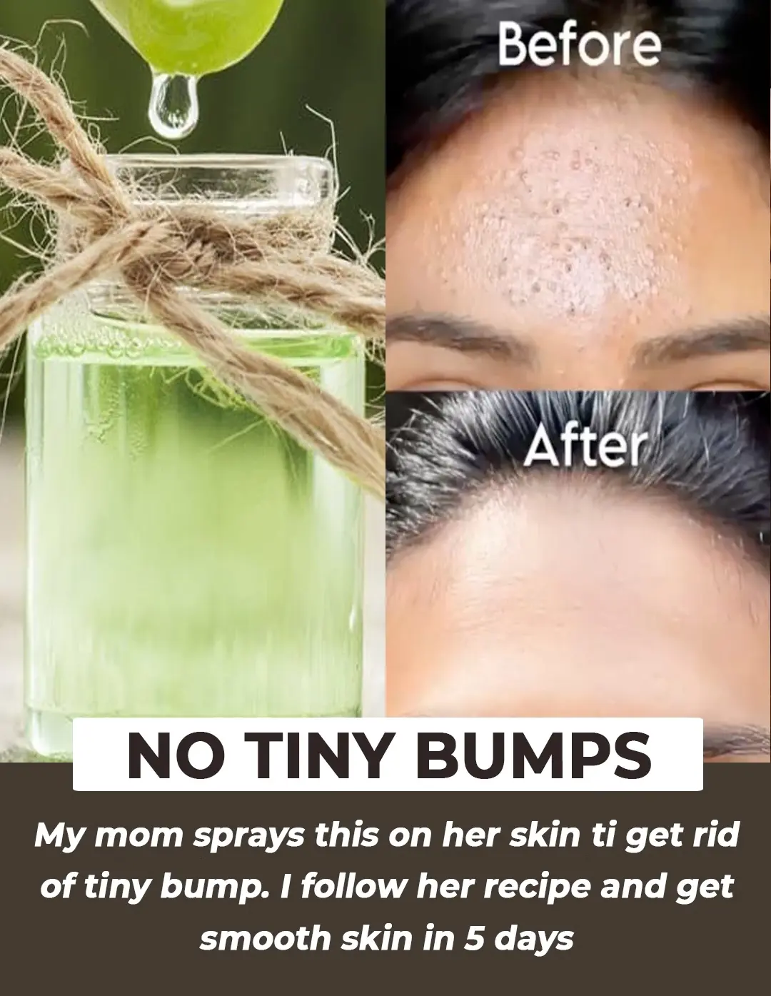 7 days challenge to get rid of tiny bumps on face