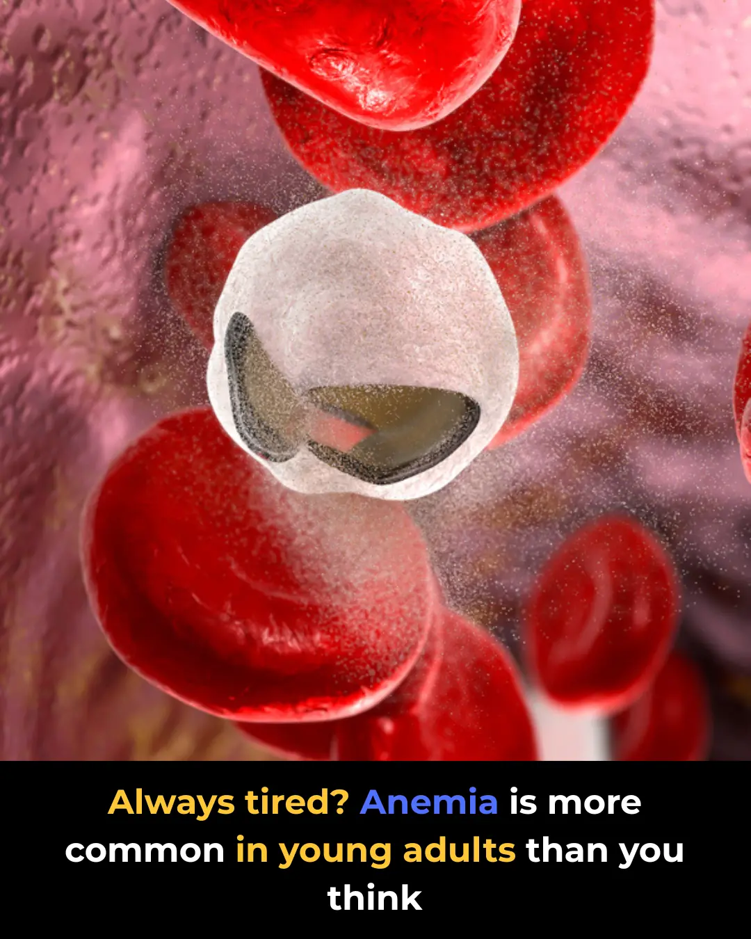 Anemia in Young Adults: Common Causes and How to Treat It