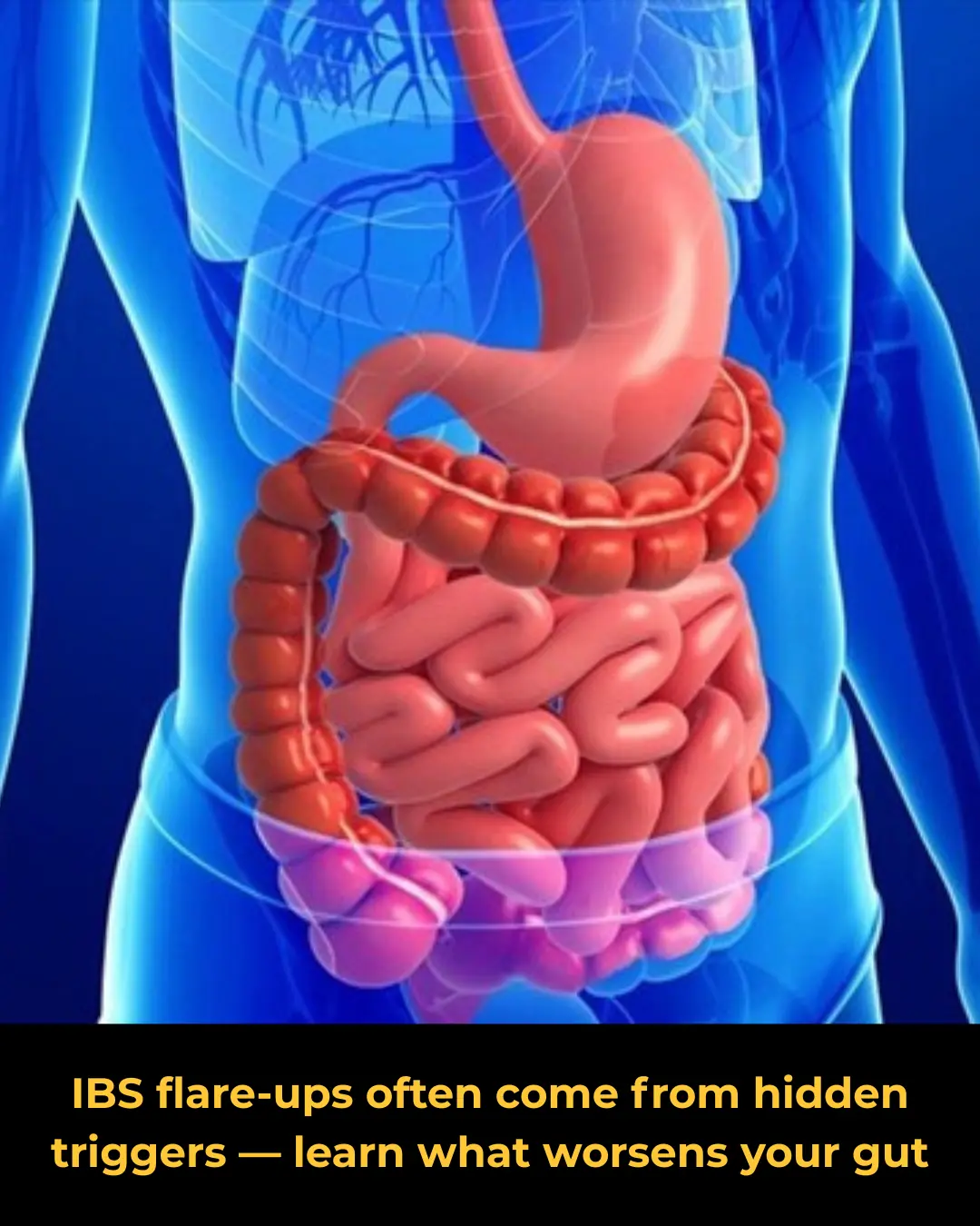 Irritable Bowel Syndrome (IBS): What Makes the Condition Worse?