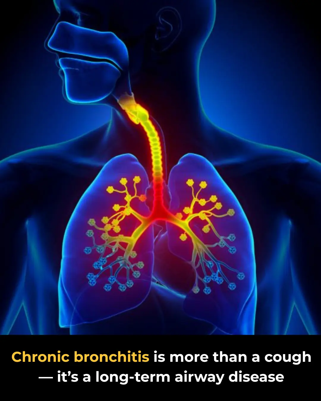 Chronic Bronchitis: Causes, Symptoms, and Home Care Tips