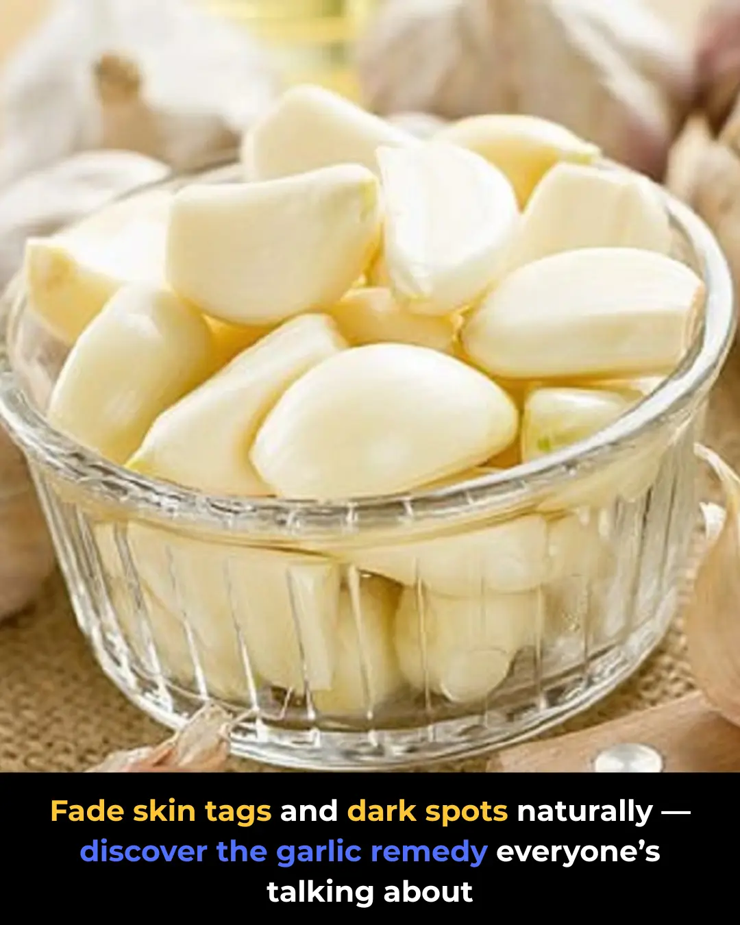 Garlic Remedy for Removing Moles and Skin Tags Naturally: What Works and What to Know