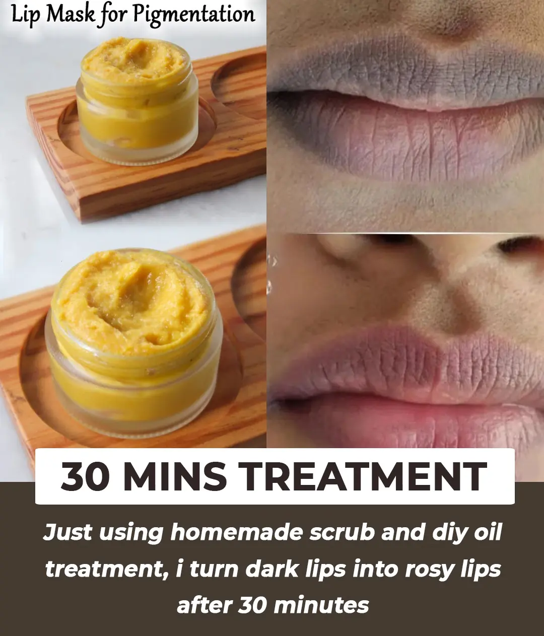 30 minutes treatment for dark lips