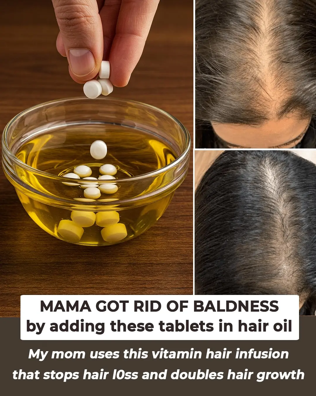 Add these tablets in your oil, no hair fall and fast hair growth