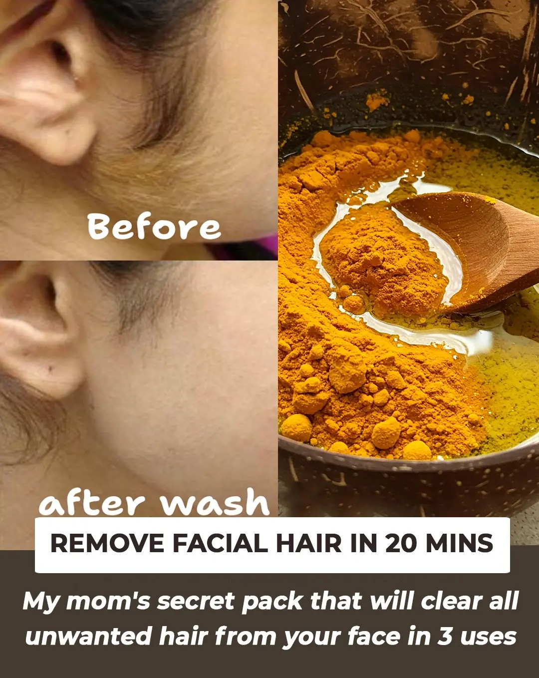 20 Minute Ubtan Rub to Get Rid of Unwanted Facial Hair
