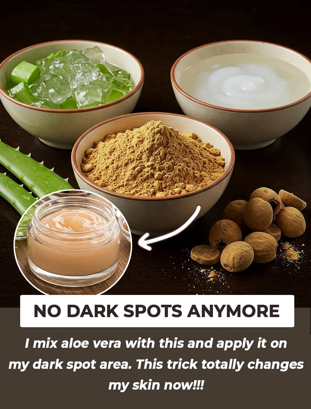 Mix Aloe Vera With This And Apply It On your Dark Spots