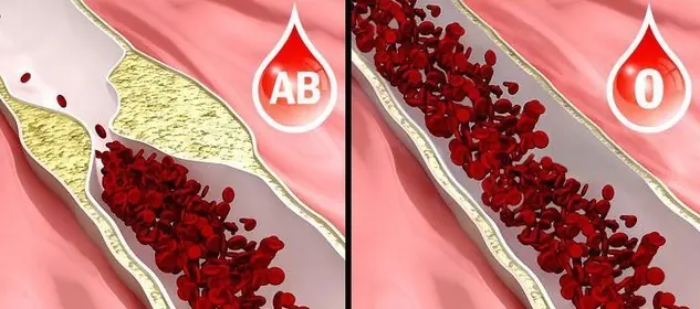 If You Carry Bl.ood Type O, You Must Know This to Protect Your Life