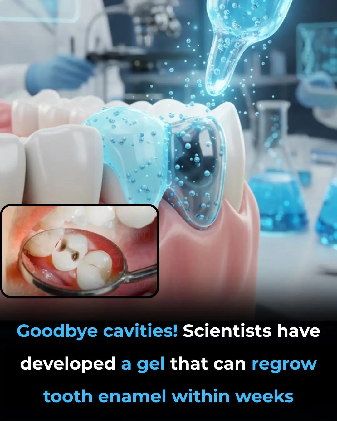 A World Without Cavities? Scientists Have Found a Way to Regrow Tooth Enamel!