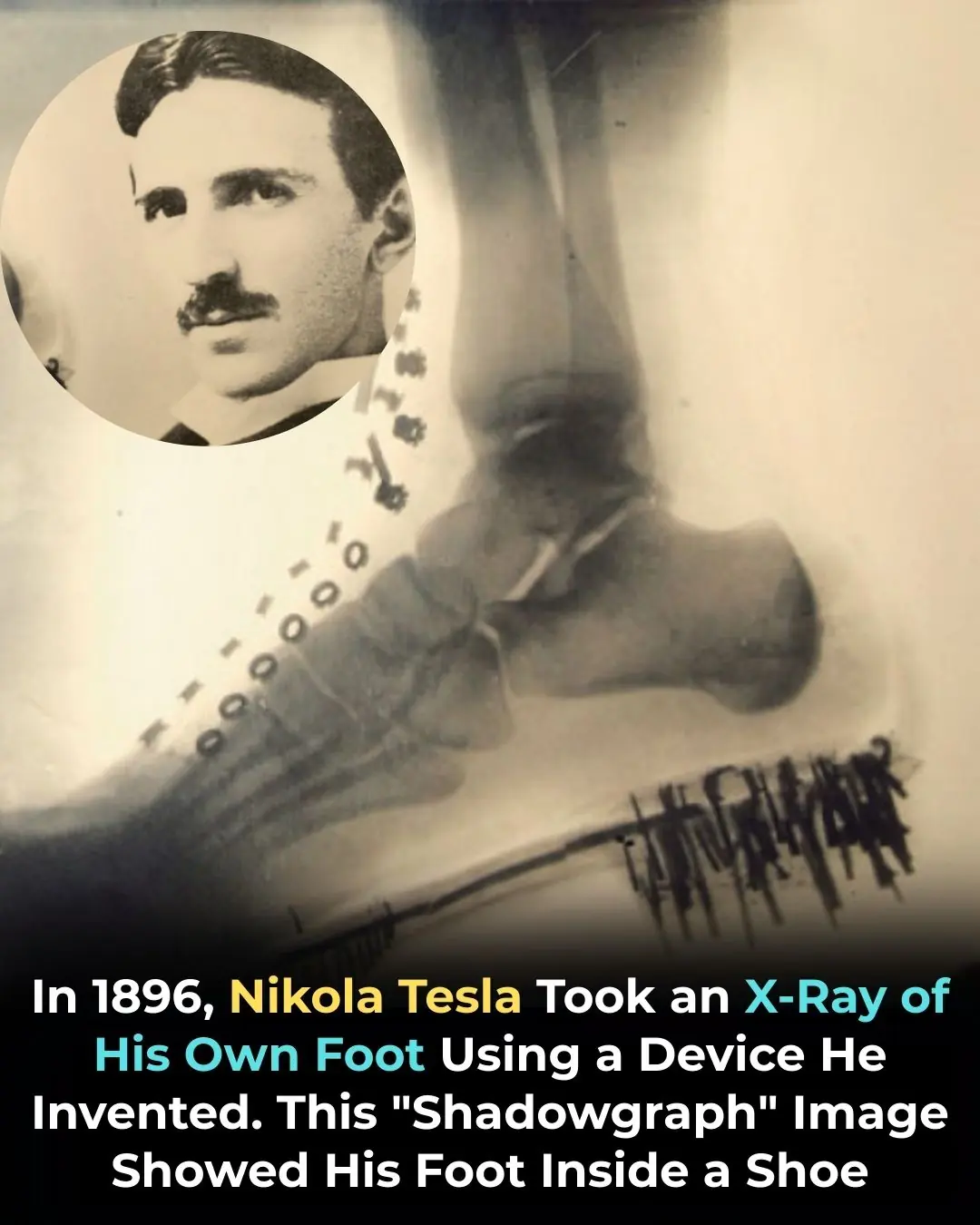 Nikola Tesla X-Rayed His Own Foot in 1896 — Pioneering the Future of Medical Imaging