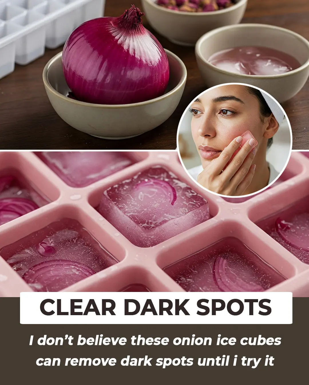 How to Get Rid of Dark Spots Using Onion Juice Ice Cubes