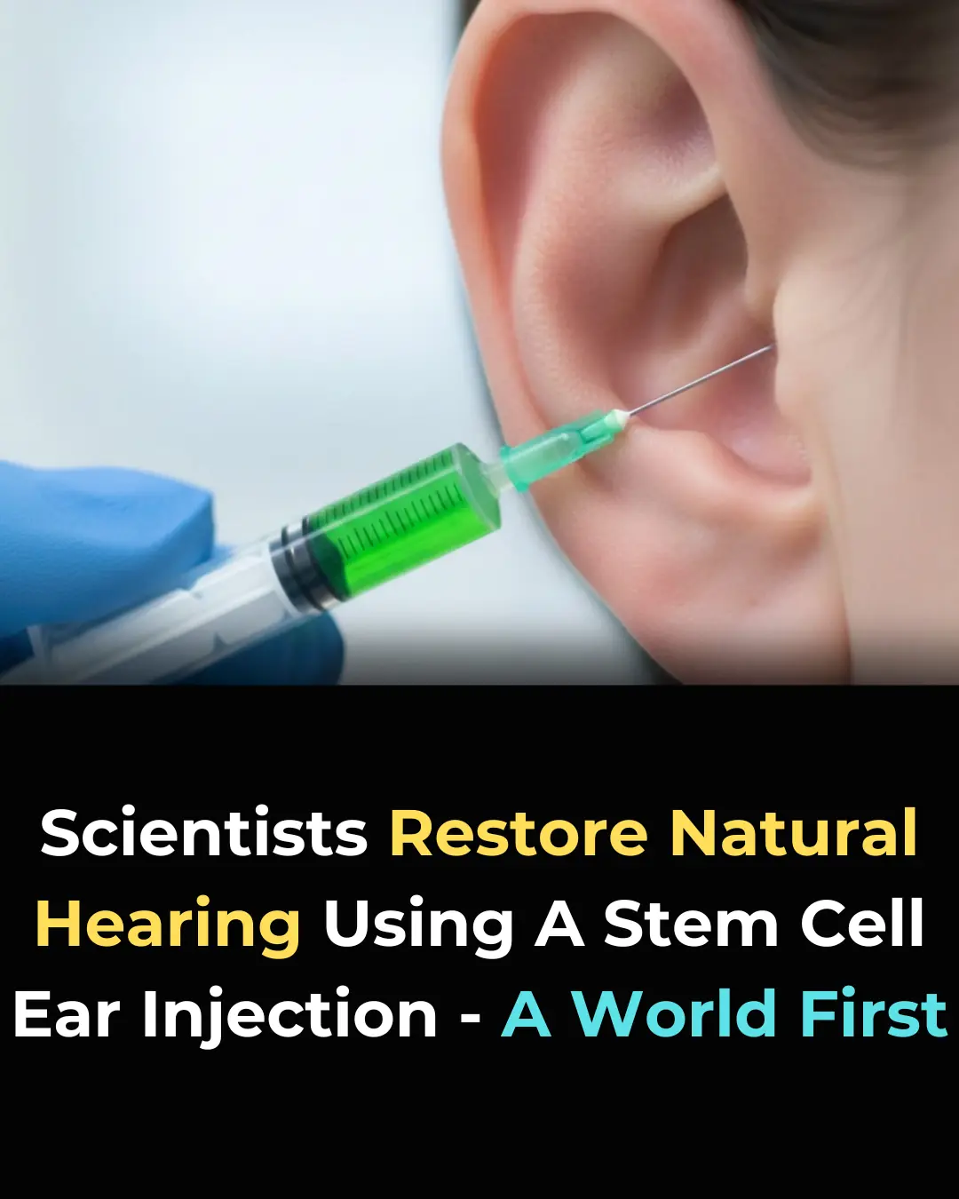 Revolutionary Stem Cell Injection Restores Natural Hearing: A Breakthrough That Could Change the Future of Medicine