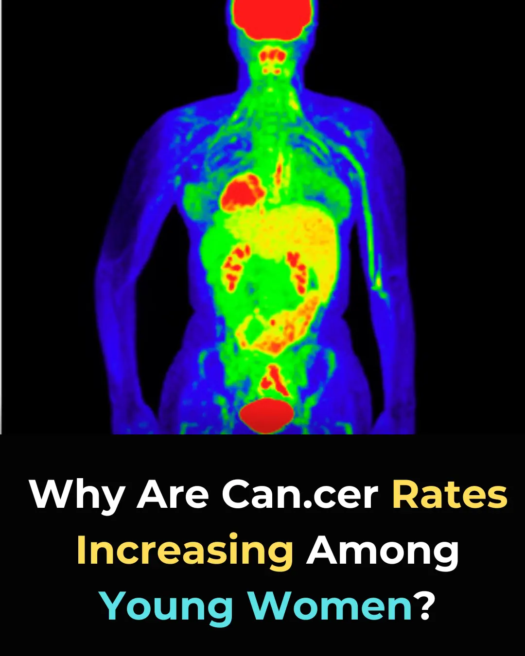Why Are Cancer Rates Among Young Women Skyrocketing? The Alarming Truth Revealed!
