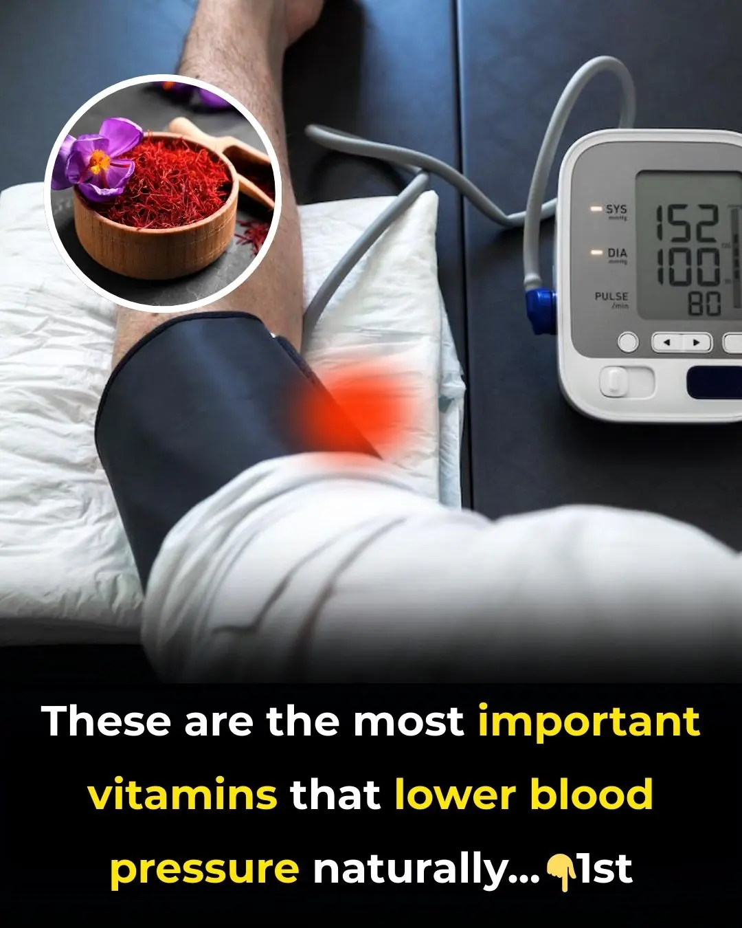 Top 13 Vitamins for High Blood Pressure – Reduce Naturally!