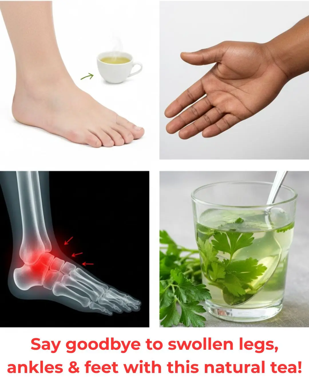 Say Goodbye to Swollen Legs