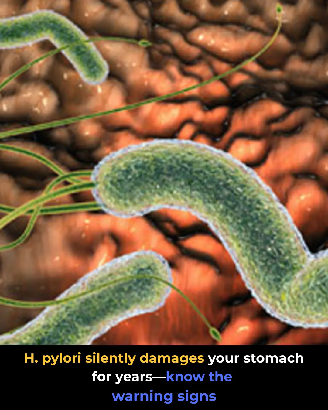 H. pylori Infection: Symptoms and How It Damages Your Stomach
