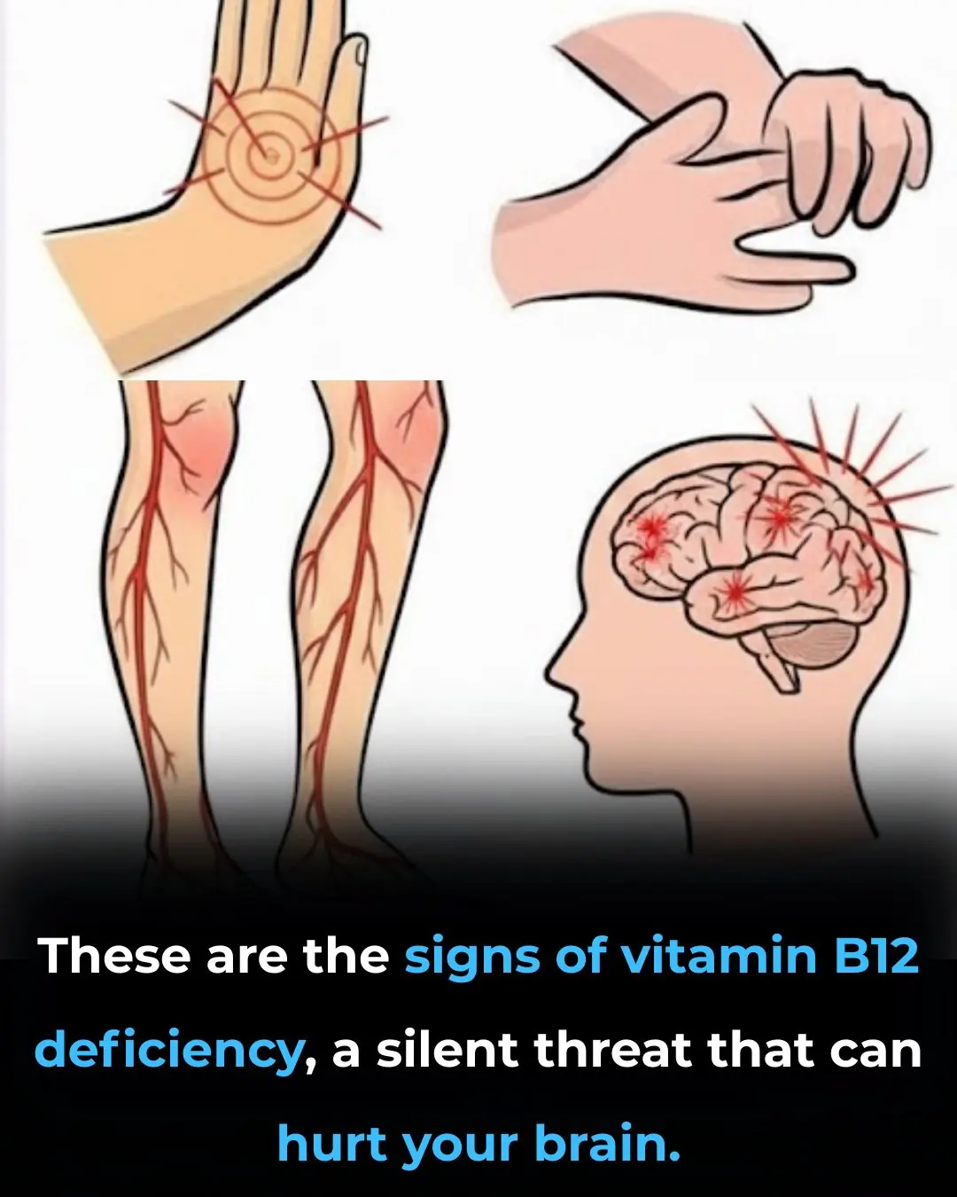 Symptoms of Vitamin B12 Deficiency