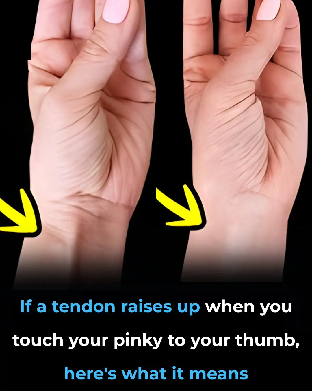 Connection Between Your Tendon and Evolution