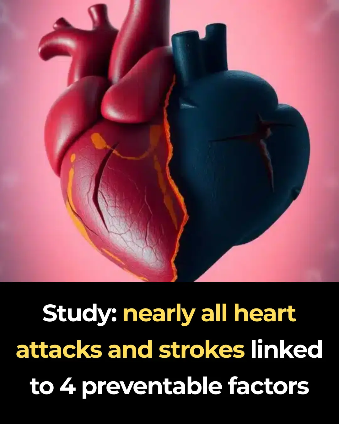 Study: nearly all heart attacks and strokes linked to 4 preventable factors