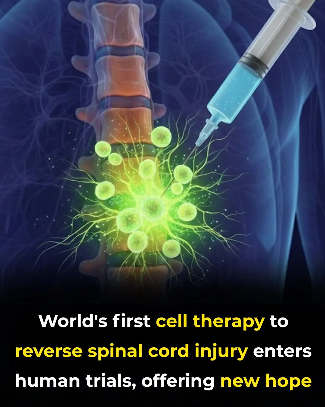 Groundbreaking Cell Therapy Offers New Hope for Spinal Cord Injury Recovery